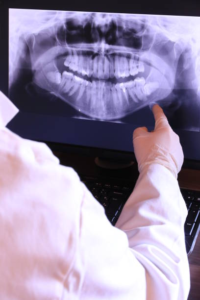 Best Emergency Treatment for Dental Infections or Abscesses in Mound, MN