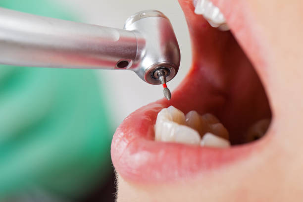 Best Emergency Gum Treatment in Mound, MN